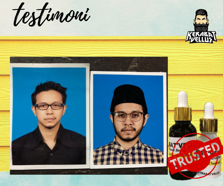 Kerabat Vellus Rahsia Berjambang Dan Rambut Kembali Lebat