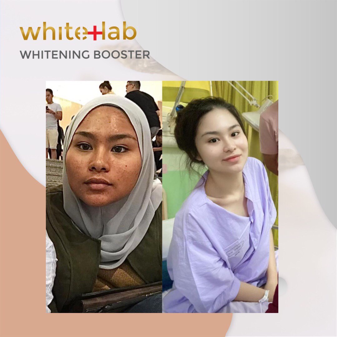 Whitelab Whitening Booster